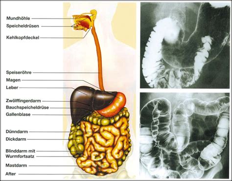 Dieses arbeitsblatt bringt den wortschatz der inneren organe des menschlichen körpers. Transparentmappe Der Mensch, Innere Organe-Gesundheit ...