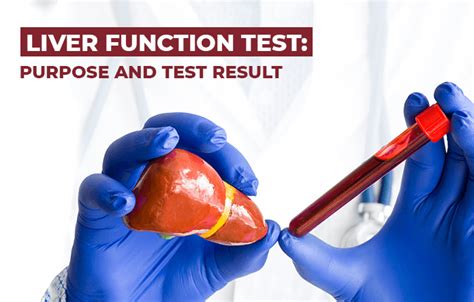 Liver Function Test Purpose And Test Result Medlife Blog Health And