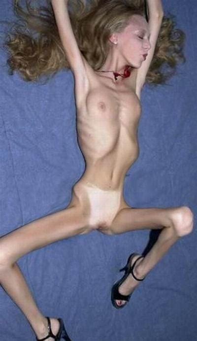 Ugly Skinny Nude Girl Pics New Porn Photos