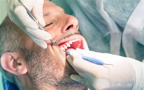 Wisdom Teeth Is An Extraction Necessary Tc Dental Group