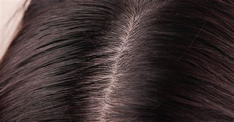 Check spelling or type a new query. How to Clean Sebum From the Scalp | LIVESTRONG.COM