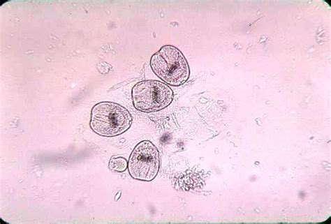 Echinococcus Granulosis