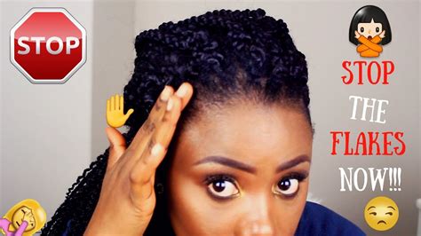 Your hair can stay healthy as it creates its own natural oils. HOW TO PREVENT GEL FROM FLAKING ON NATURAL HAIR ( TIPS AND ...