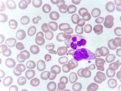 Monocyte Och Neutrophilcell I Blodsudd Arkivfoto Bild Av