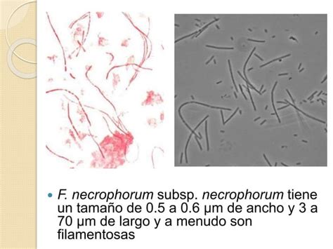 Fusobacterium Necrophorum