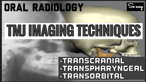 Temporomandibular Joint Radiographic Imaging Techniquesi Transcranial