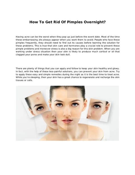 How To Get Rid Of Pimples Without Popping Them Read Our Reviews Now