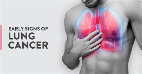 The Early Signs Of Lung Cancer Ck Birla Hospital