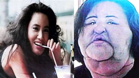 Korean Hang Mioku Injected Cooking Oil On Her Face Is She Still Alive