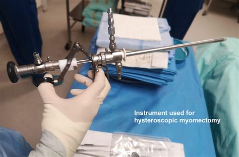 Hysteroscopy Diagnostic And Operative Womens Health By Dr Lee Say Fatt