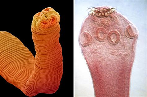 Man Dies After Getting Crazy Cancer From Killer Tapeworm Living Inside Him Daily Star
