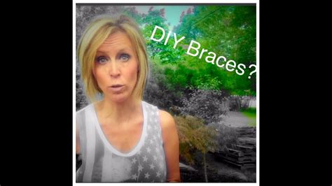 Dental Vlogger Anastasia Shares How Diy Braces Can Kill Teeth Youtube