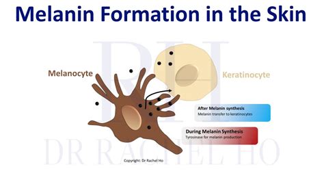 Dr Rachel Ho Melanin Formation In Skin 1