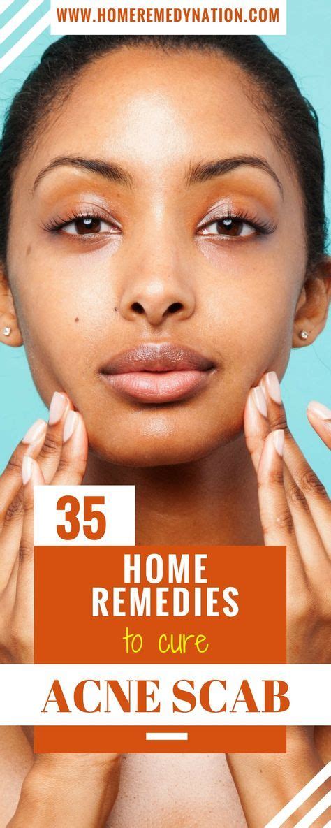 Drinking more water than usual when you're sunburned can help keep you from. 35 Efficacious Home Remedies to Get Rid of Acne Scabs ...