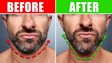 How To Fix A Soft Face Weak Jawline Asap Youtube