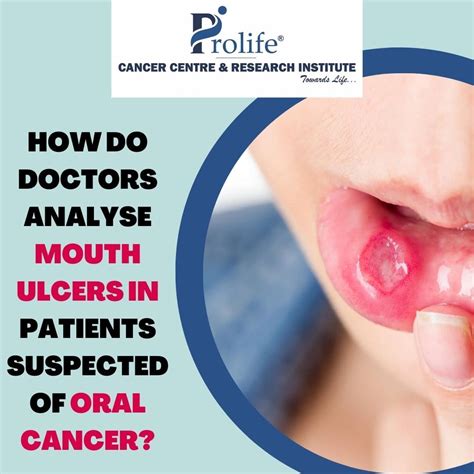 How Doctors Analyse Mouth Ulcers In Patients Suspected Of Oral Cancer