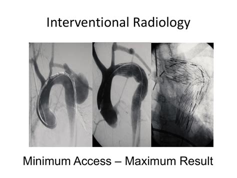 Powerpoint Presentation Interventional Radiology