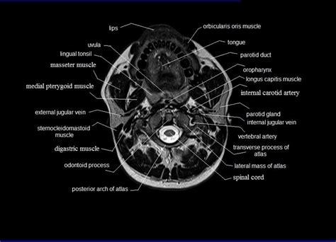 This muscle is responsible for elevating and depressing the scapula, and it can also retract the scapula. MRI neck anatomy | free MRI axial neck cross sectional anatomy | Mri, Vertebral artery, Anatomy