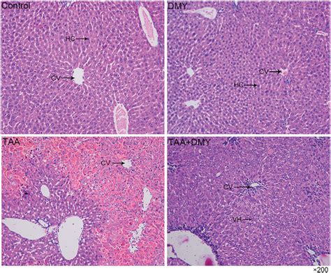 Hande Staining Of The Liver 200Â The Histopathology Of Control And Dmy