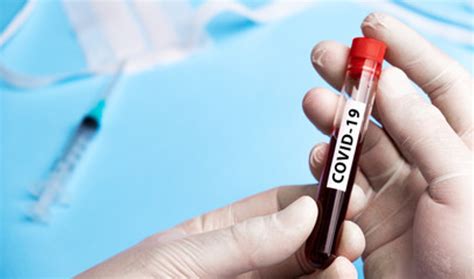 Covid travel certificate request form. RT-PCR Covid-19 Test & Travel Certificate | The Montague ...