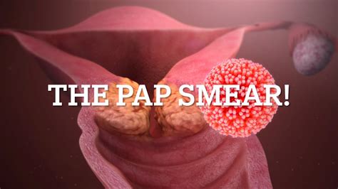 Pap Smear YouTube