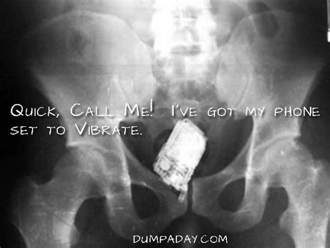 Dump A Day Amazing X Rays Of Random Objects Inserted Into Bizarre Places 15 Pics X Ray