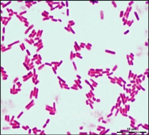 E Coli Gram E Coli