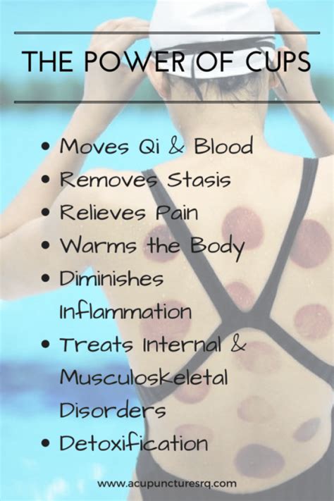 Why Is Cupping Therapy Becoming So Popular Lakewood Ranch Acupuncture And Wellness