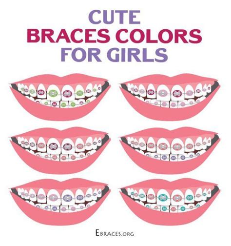 Braces Colors For Girls Dental Braces Colors Cute Braces Cute Braces Colors