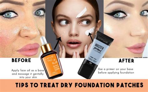 How To Treat Dry Patches After Applying Foundation