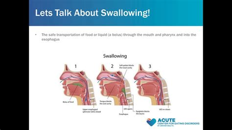 Dysphagia Difficulty Swallowing And Eating Disorders Youtube