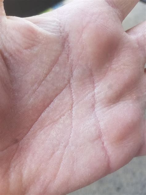 I Have Hundreds Of Tiny Holes In My Hand Rwtf