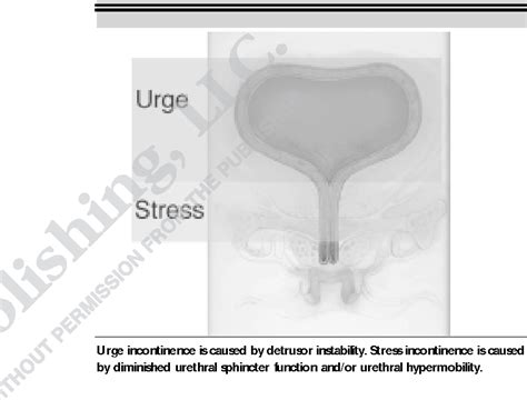 Figure 1 From The Epidemiology And Evaluation Of Urinary Incontinence