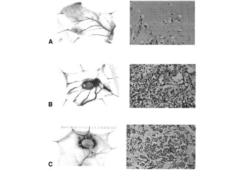 Photomicrographs Of Subcutaneous PC12 Xenografts To Nude Mice