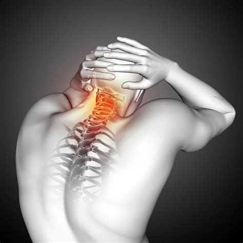 Myofascial Pain Syndrome Cause Symptoms Treatment Exercise