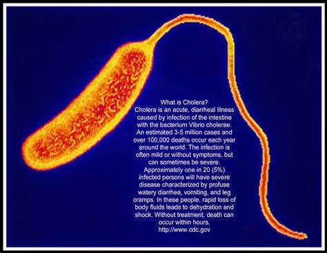 Transmission Signs And Symptoms Of Cholera Health And Disease