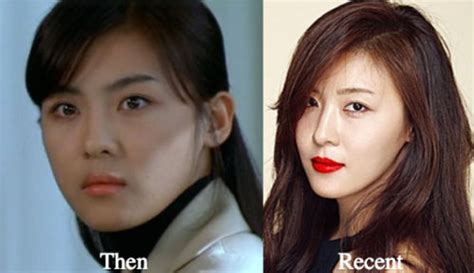 Ha Ji Won Plastic Surgery Before And After Photos