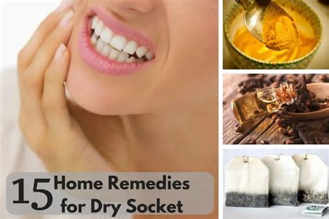 15 Home Remedies For Dry Socket
