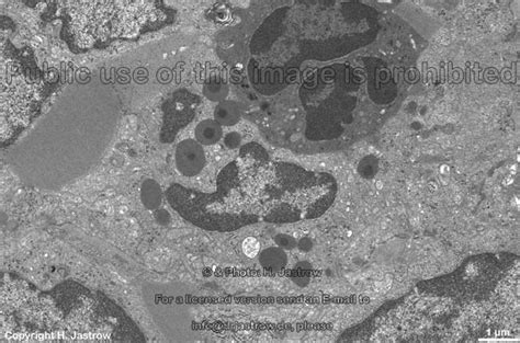 Basophile Granulocytes Drjastrows Electron Microscopic Atlas