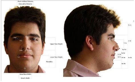 Computer Generated Facial Measurements For Orthodontics Naked Images Comments