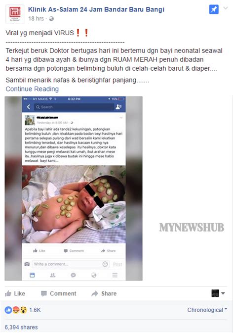 Tapi demam ini sebenarnya bukanlah penyakit. 'Viral Yang Menjadi Virus' Rawat Deman Kuning Bayi - MYNEWSHUB