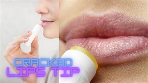This Winter How To Avoid Cracked Lips Youtube