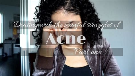 Dealing With The Struggles Of Acne Part 1 Youtube