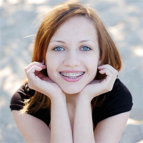 Pretty Girl Wearing Braces Smiling Cheerfully Orthodontics