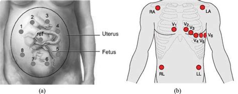 Non Invasive Detection And Compression Of Fetal