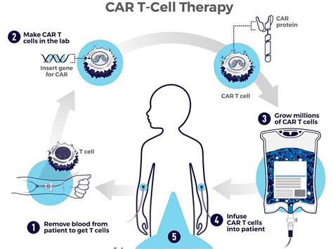 Car T Cell Therapy Process