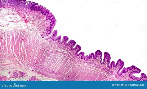 Cross Section Of Stomach Light Micrograph Showing Stomach Epithelium