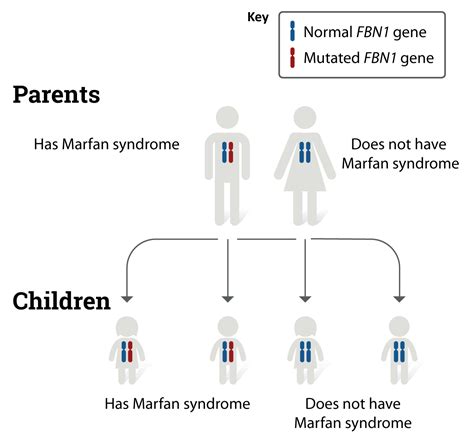 Understanding Marfan Syndrome Causes Symptoms Treatme