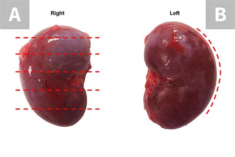 Image Gallery Autopsy For The General Practitioner Clinicians Brief