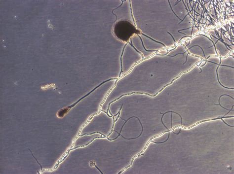 Incelligence Bacteria Yeast Fungi